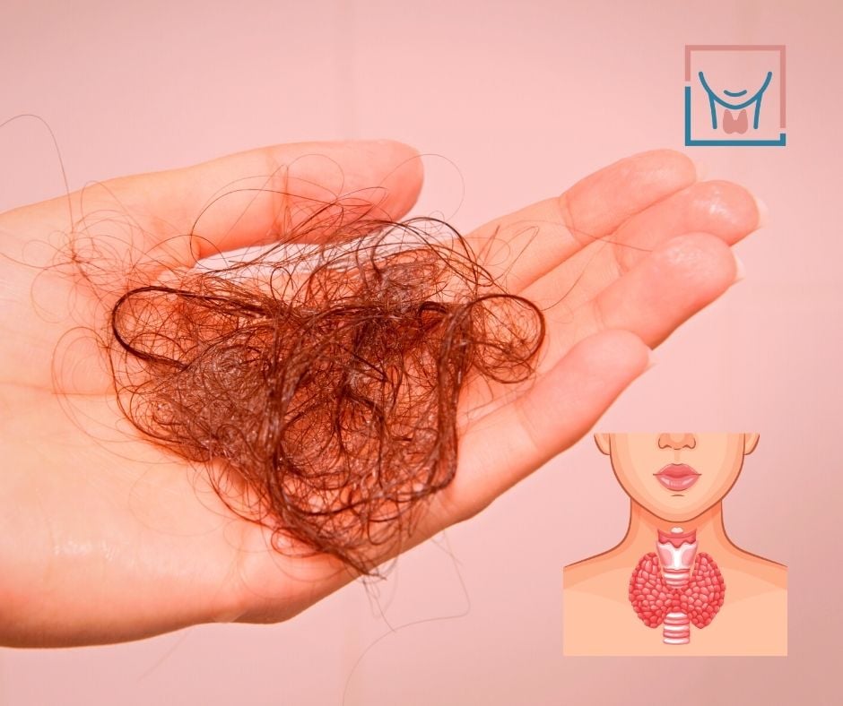 Thyroid Hair Loss Why It Happens and How to Grow It Back